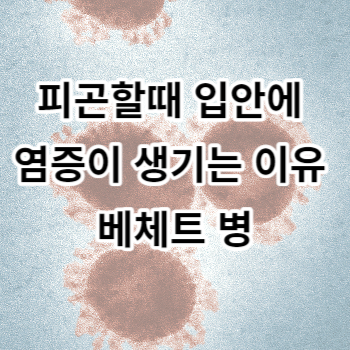 피곤할때 입안에 염증이 생기는 이유 베체트 병