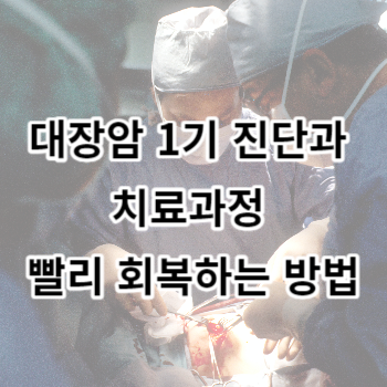 대장암 1기 진단과 치료과정 빨리 회복하는 방법