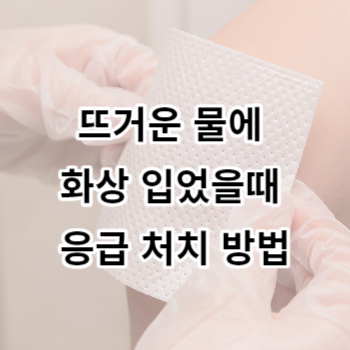 뜨거운 물에 화상 입었을때 응급 처치 방법