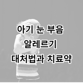 아기 눈 부음 알레르기 대처법과 치료약