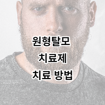 원형탈모 치료제와 치료 방법