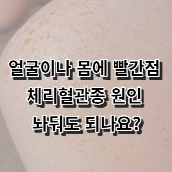 얼굴이나 몸에 빨간점 체리혈관종 원인 놔둬도 되나요?