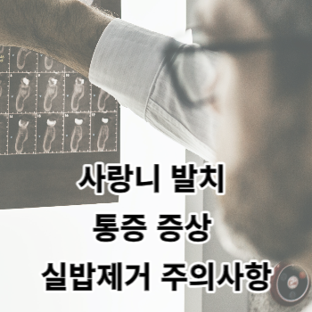 사랑니 발치 통증 증상 실밥제거 주의사항