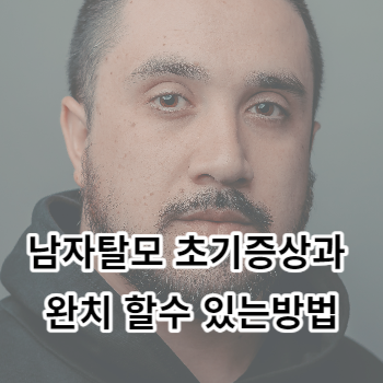 남자탈모 초기증상과 완치 할수 있는방법