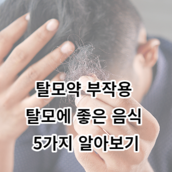 탈모약 부작용 탈모에 좋은 음식 5가지 알아보기