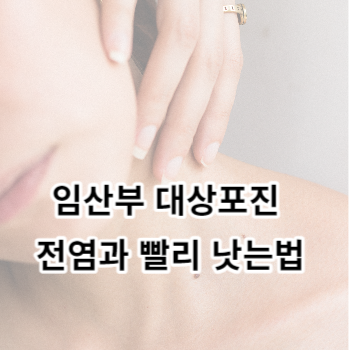 임산부 대상포진 전염과 빨리 낫는법