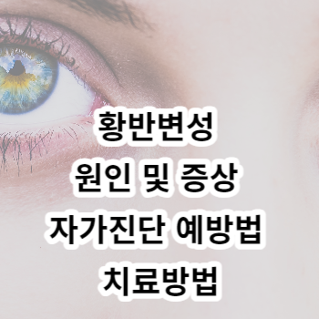 황반변성 원인 및 증상 자가진단 예방법 치료방법