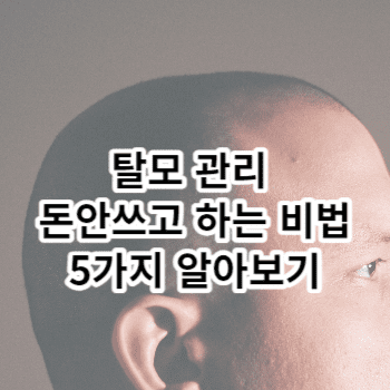 탈모 관리 돈안쓰고 하는 비법 5가지 알아보기