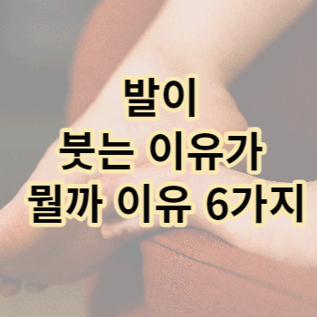 발이 붓는 이유가 뭘까 이유 6가지