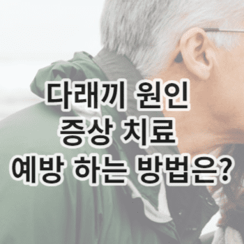 다래끼 원인 증상 치료 예방 하는 방법은?