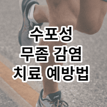 수포성 무좀 감염 치료 예방법 