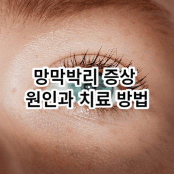 망막박리 증상 원인과 치료 방법