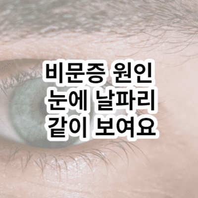 비문증 원인 눈에 날파리 같이 보여요