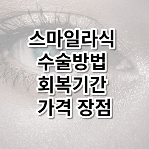 스마일라식 수술방법 회복기간 가격 장점