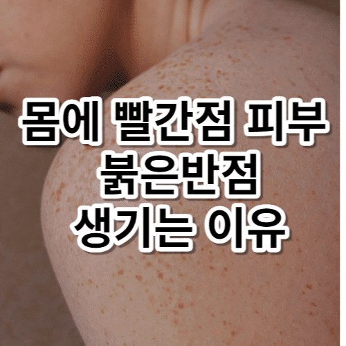 몸에 빨간점 피부 붉은반점 생기는 이유